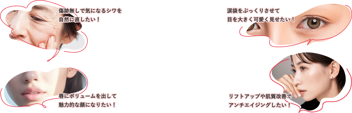 傷跡無しで気になるシワを自然に直したい！涙袋をぷっくりさせて目を大きく可愛く見せたい！唇にボリュームを出して魅力的な顔になりたい！リフトアップや肌質改善でアンチエイジングしたい！