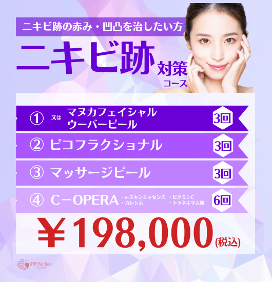 【ニキビ跡】対策コースの公式キャンペーンバナー