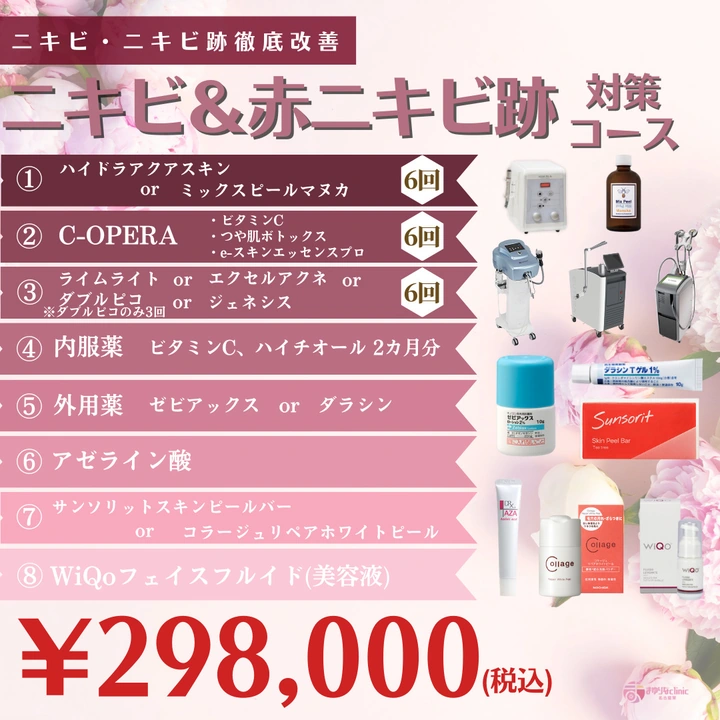 ニキビ＆ニキビ跡対策コースの公式キャンペーンバナー