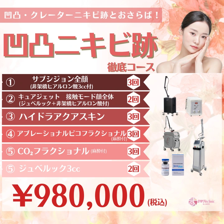 凹凸ニキビ跡徹底コース〈モニター〉の公式キャンペーンバナー