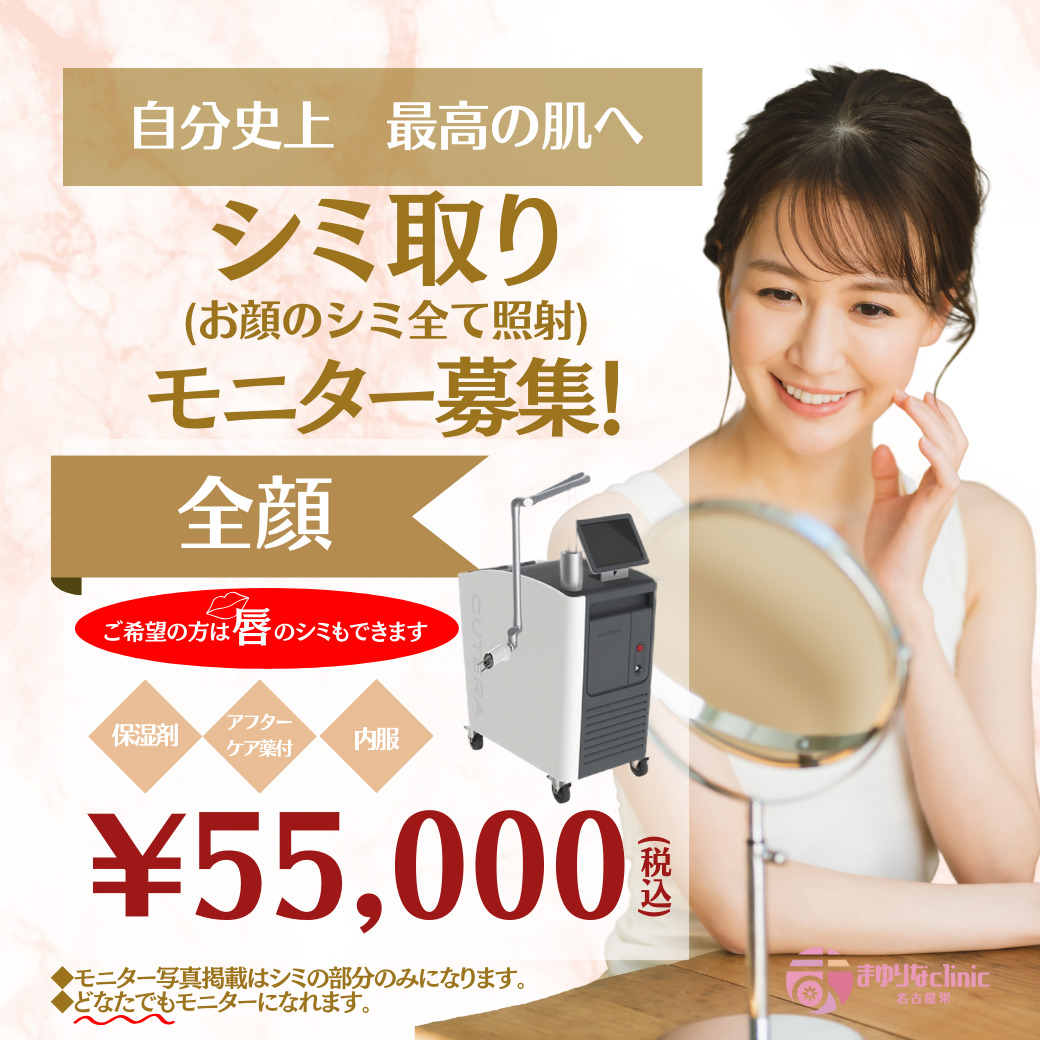 シミ取り（お顔のシミ全て照射）のキャンペーンバナー