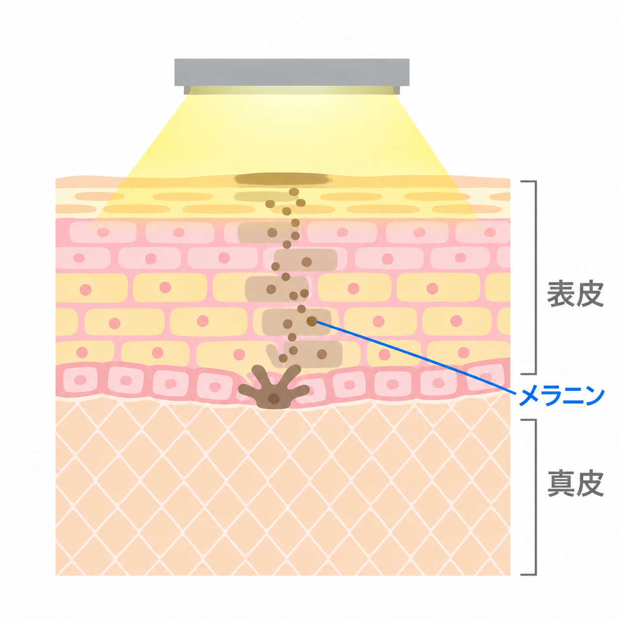 ライムライトの照射方法のイメージ(模式図)。広い範囲の黄色いIPLの光を、表皮浅層まで描写。表皮内の中央に集まるメラニンと表皮・真皮の位置を表示。光の色・広がり・深さ、皮膚の厚さは説明用で、実際の縮尺とは異なります。