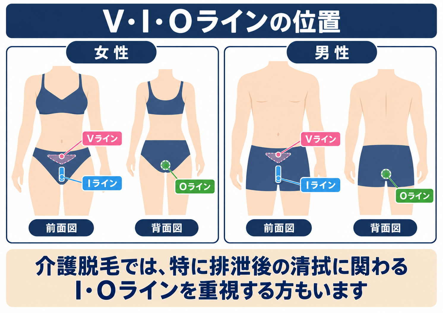 介護脱毛の対象となるVライン・Iライン・Oラインの位置と排泄後の清拭に関係する部位を示した図