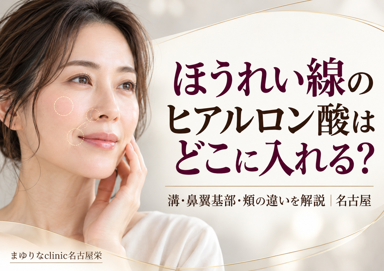 ほうれい線のヒアルロン酸はどこに入れる?溝・鼻翼基部・頬の違いを解説|名古屋
