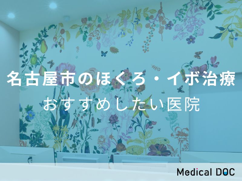 Medical DOC-【2023年】名古屋市のほくろ・イボ治療おすすめしたい6医院に掲載されました。