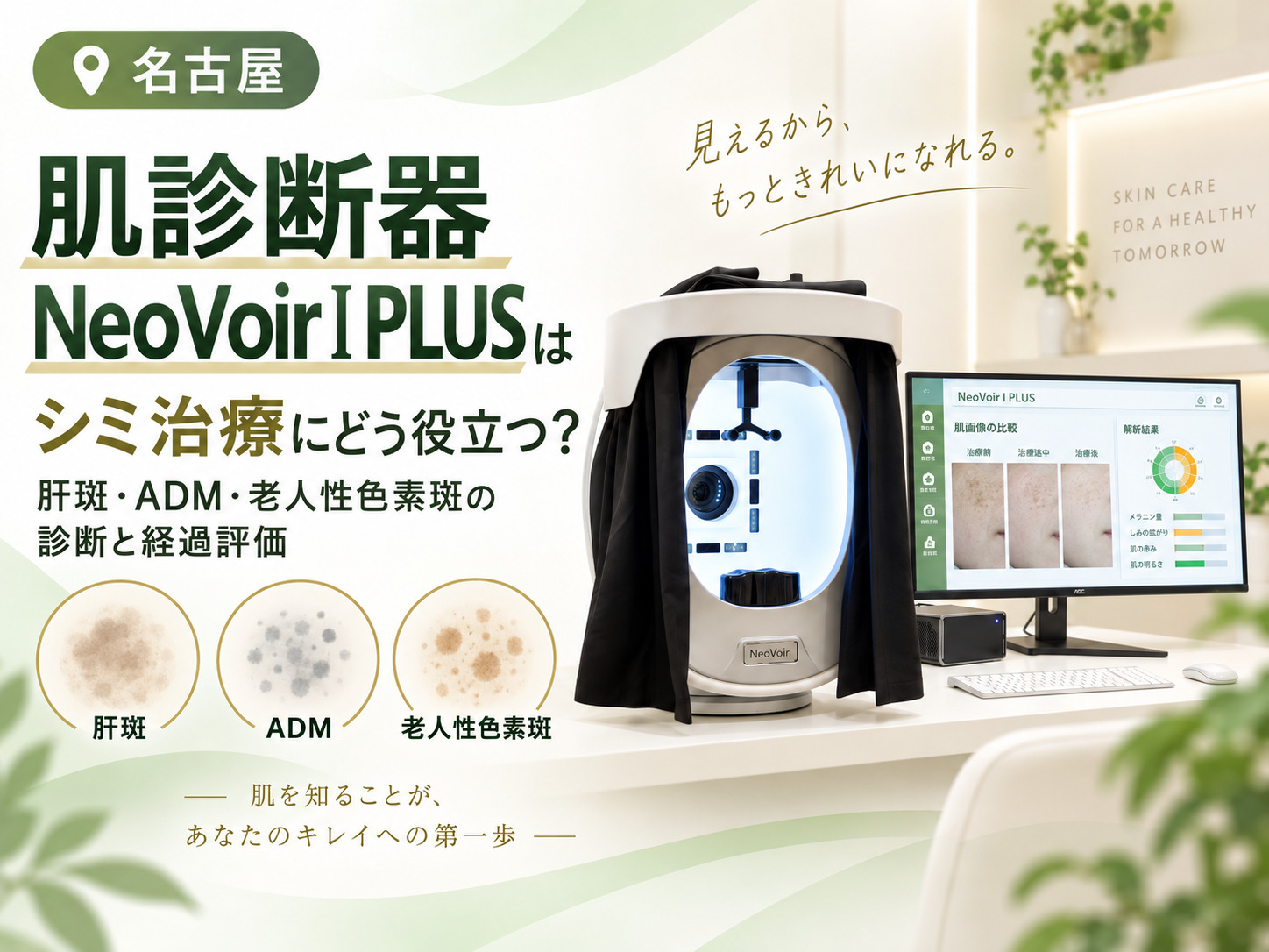 肌診断器NeoVoirⅠPLUSはシミ治療にどう役立つ？肝斑・ADM・老人性色素