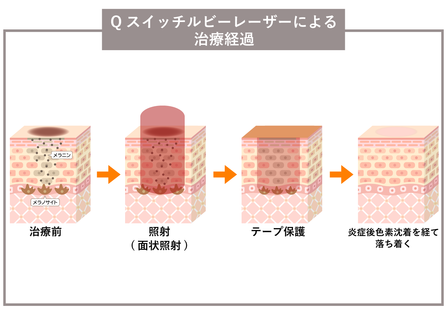 左寄せ画像