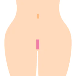 Iライン型