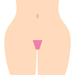 スクエア型