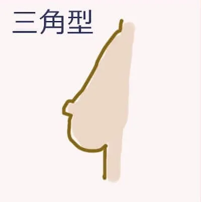 三角形型バスト