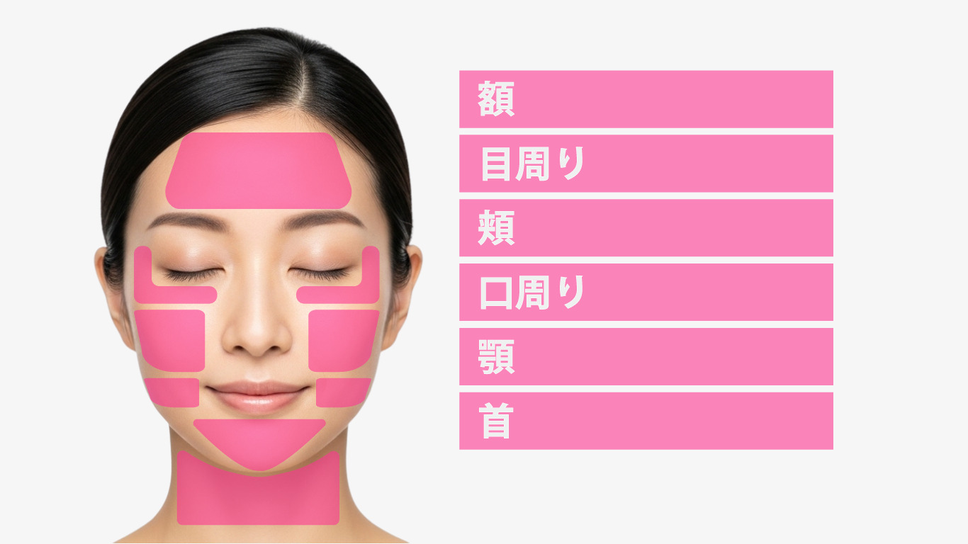 ピンクグロー 注入部位