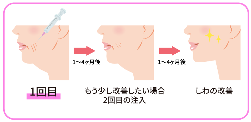 CGスタイラー　施術間隔