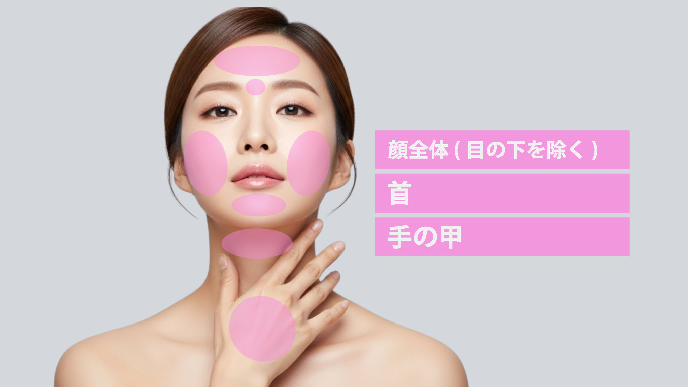 プルリアルデンシファイ 注入部位