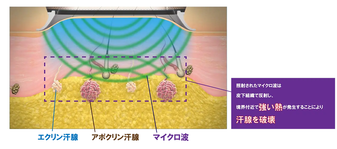 左寄せ画像