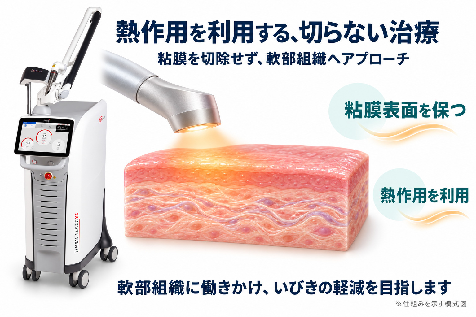 非蒸散性Er:YAGレーザーが粘膜を介して軟部組織へ熱作用を与える仕組みの模式図