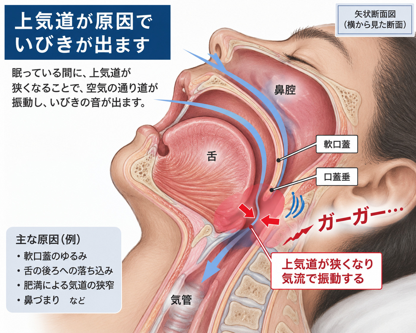 鼻腔から咽頭へ続く上気道と軟口蓋・口蓋垂・舌根部を示す矢状断面図