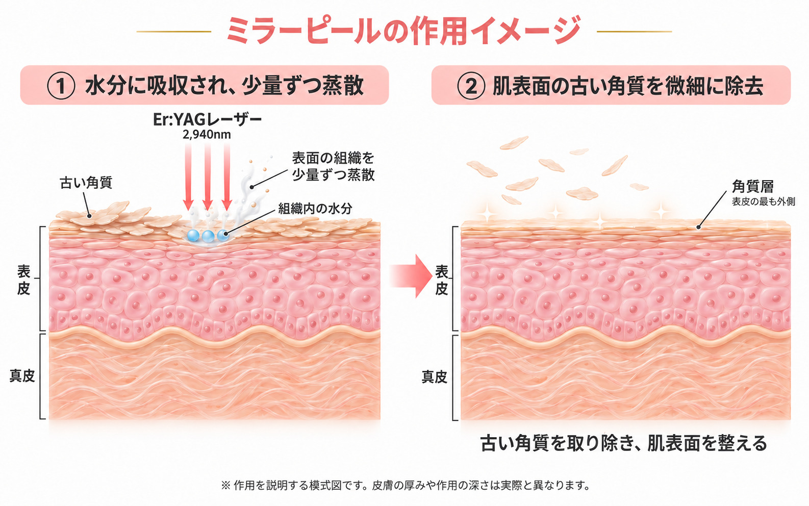 ミラーピールの仕組み