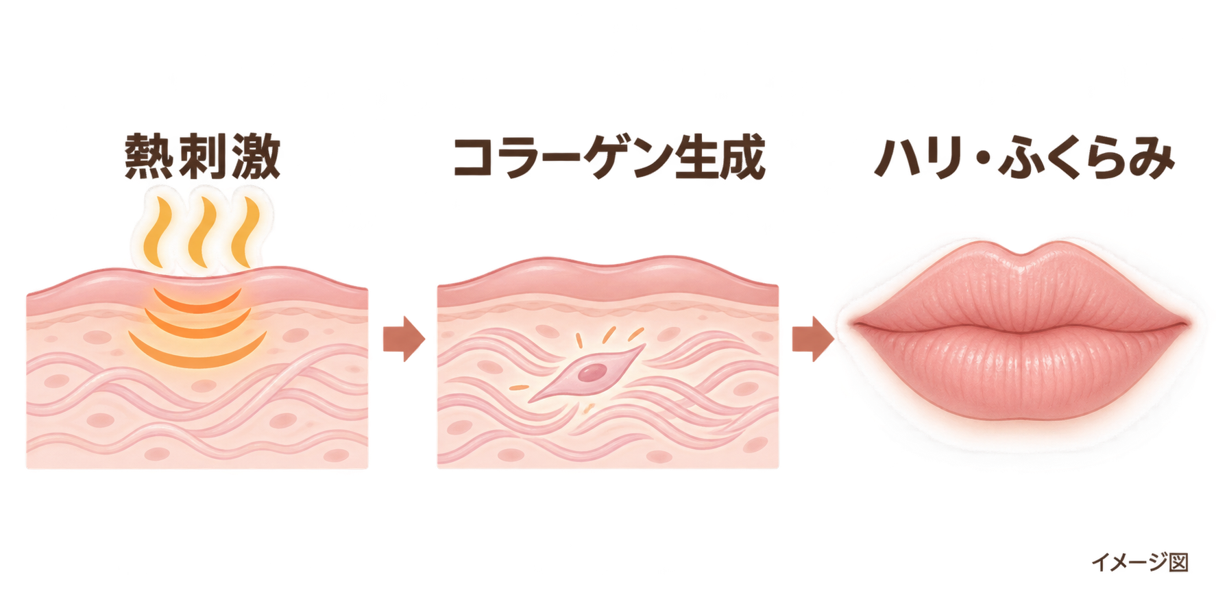 熱刺激 → コラーゲン生成 → ハリ・ふくらみ