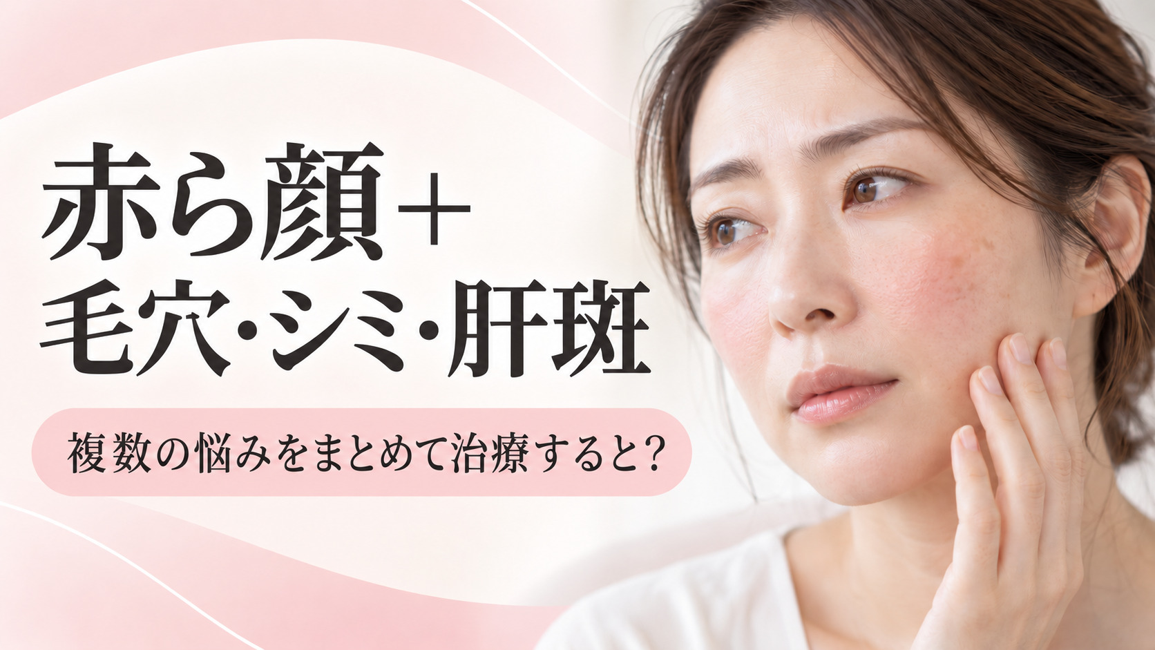 赤ら顔+毛穴・シミ・肝斑がある場合はどう治療する?複数の悩みをまとめて治療する方法|名古屋