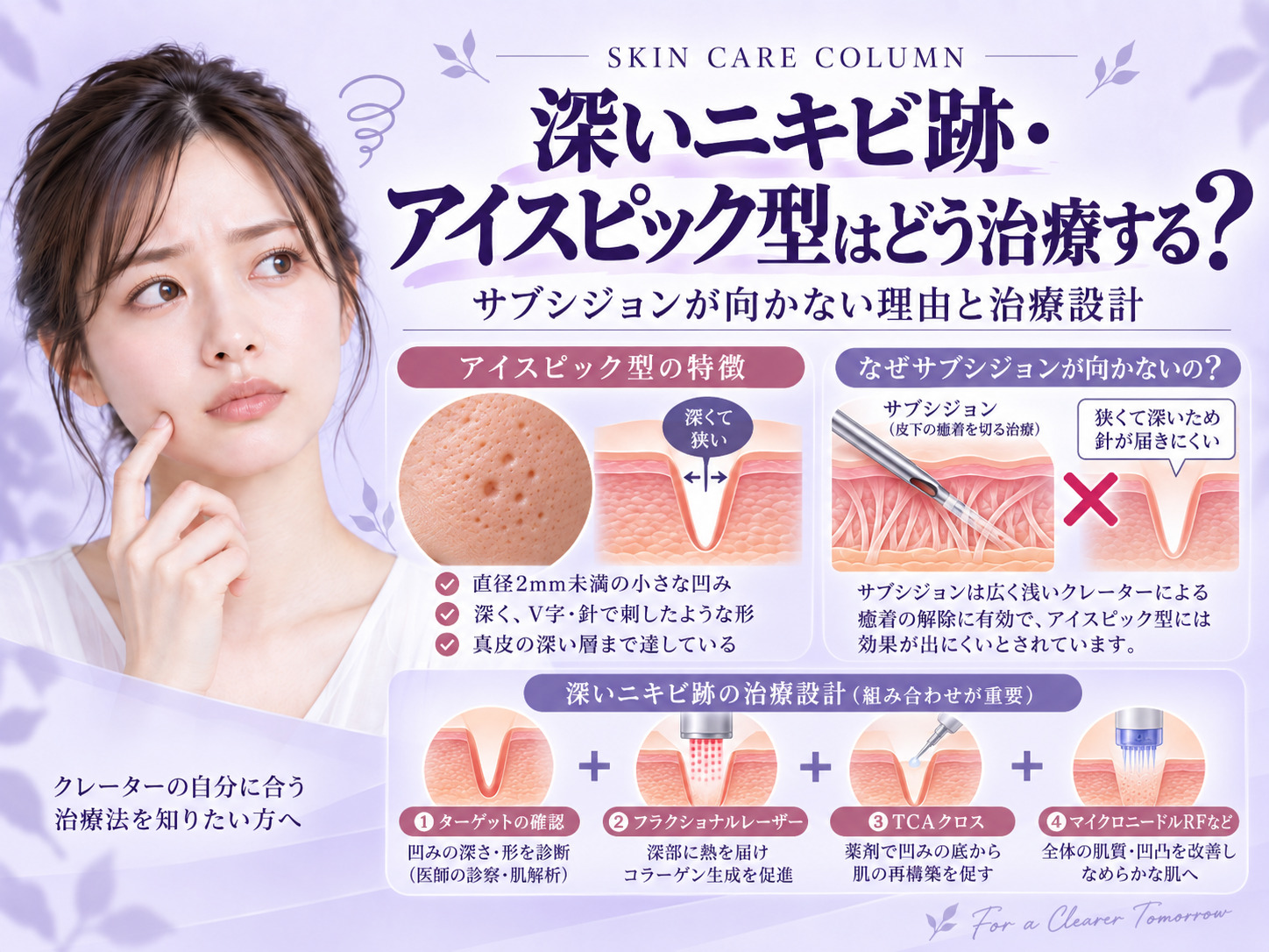 アイスピック型ニキビ跡はどう治療する?深いクレーターの治療設計を解説|名古屋