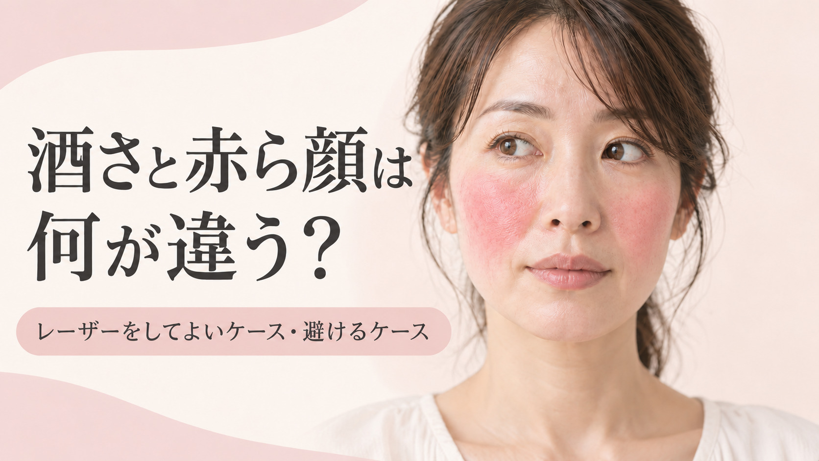 酒さと赤ら顔は何が違う?美容レーザーをしてよいケース・避けるケース|名古屋