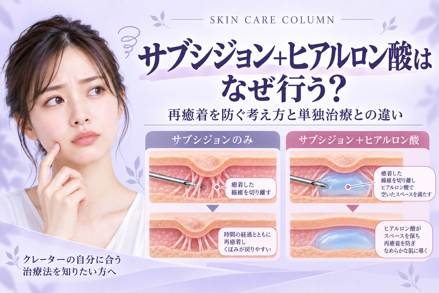 サブシジョン+ヒアルロン酸はなぜ行う?再癒着を防ぐ考え方と単独治療との違い|名古屋