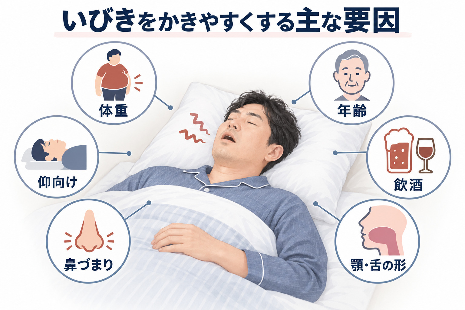 いびきをかきやすくする主な要因|体重・年齢・飲酒・仰向け・鼻づまり・顎や舌の形