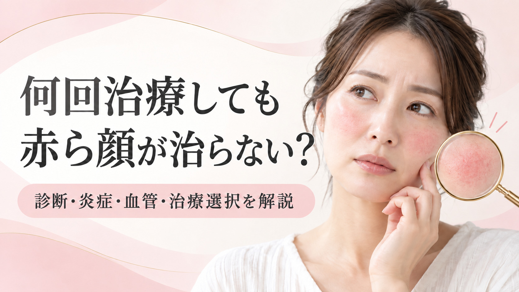赤ら顔治療を何回しても治らない理由は?診断・炎症・血管・治療選択から解説|名古屋