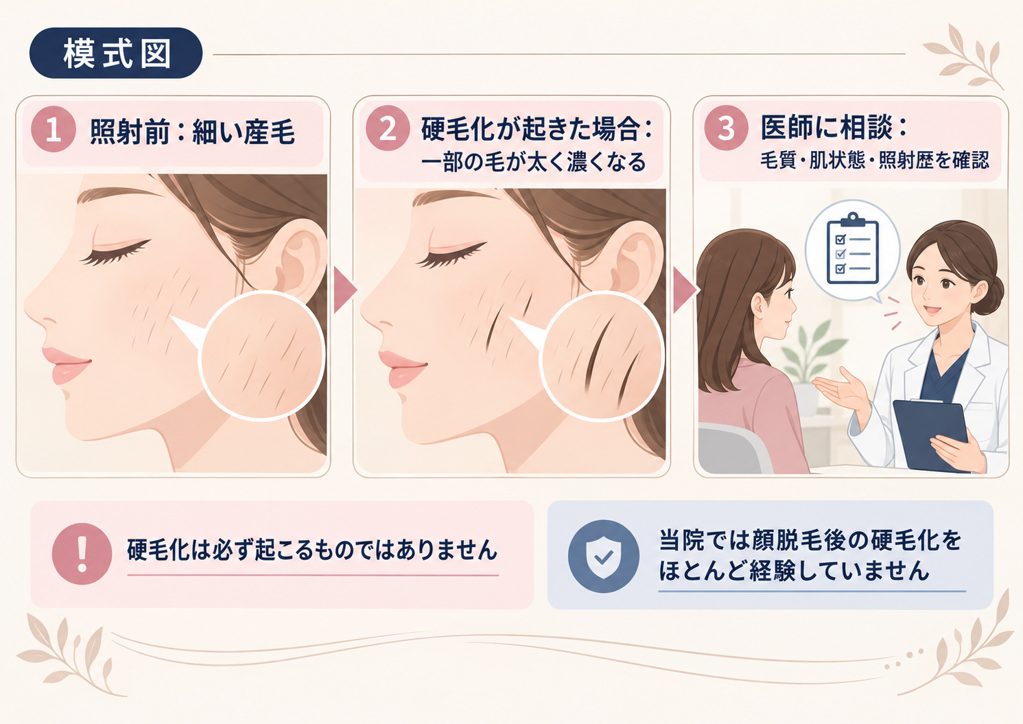 顔脱毛後の硬毛化とは?毛の変化と相談の流れ 顔脱毛後にまれにみられる硬毛化のイメージと医師が照射歴や毛質を確認する流れを示した模式図