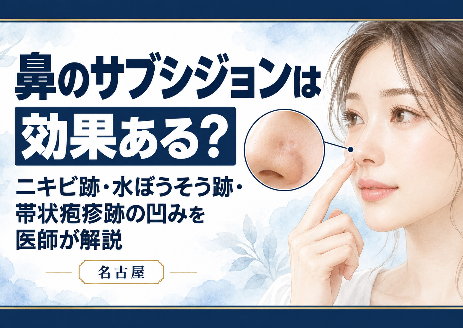 鼻のサブシジョンは効果ある?ニキビ跡・水ぼうそう跡・帯状疱疹跡の凹みを医師が解説【名古屋】