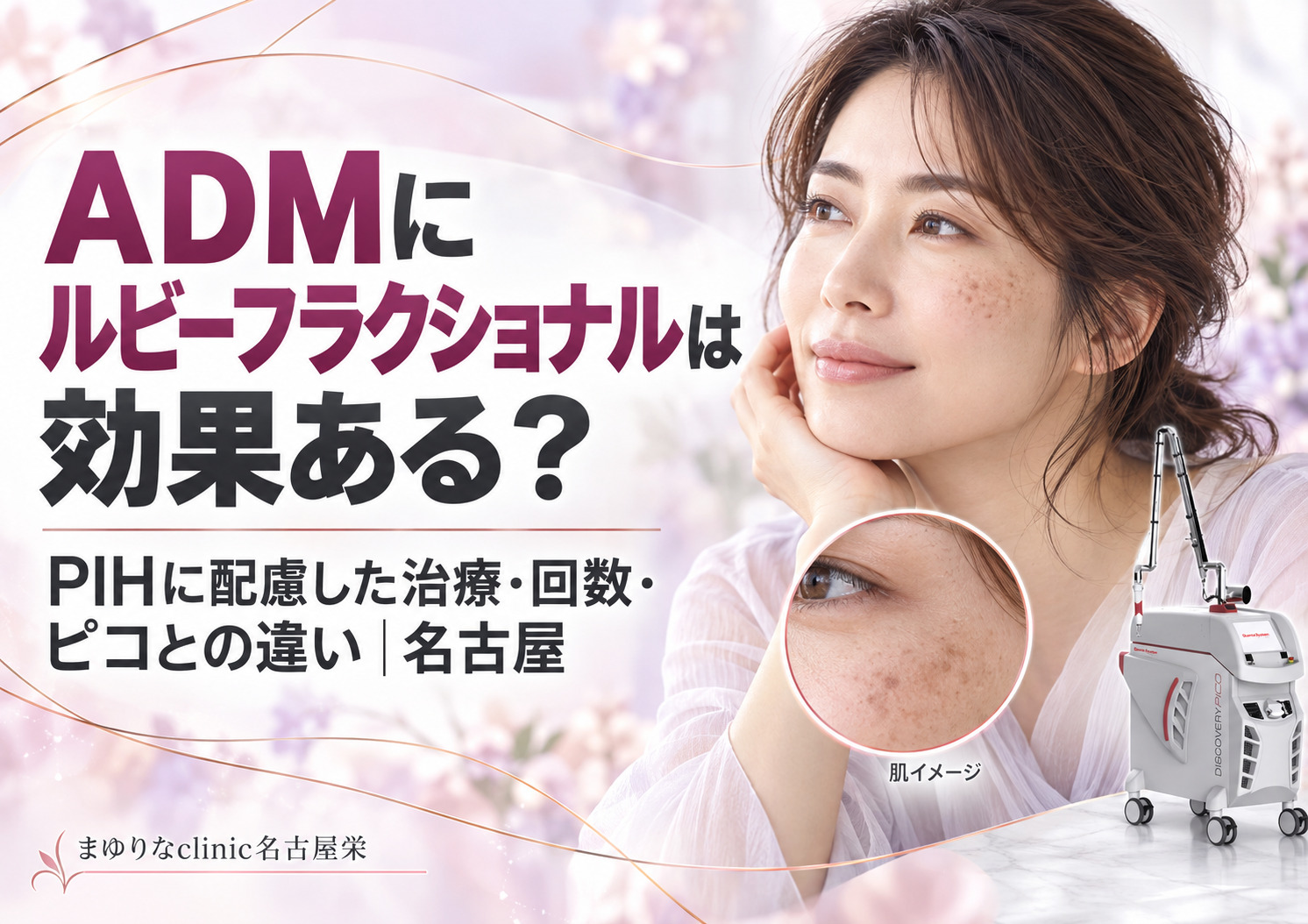 ADMにルビーフラクショナルは効果ある?治療期間・PIH・ピコとの違いを解説|名古屋