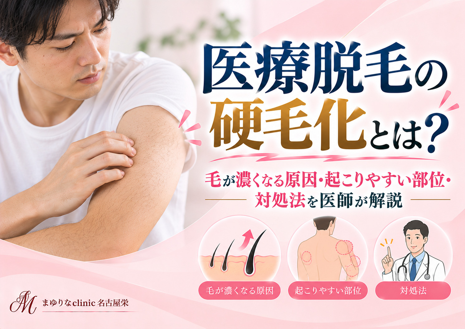 医療脱毛の硬毛化とは？毛が濃くなる原因・起こりやすい部位・対処法を医師が解説｜名古屋