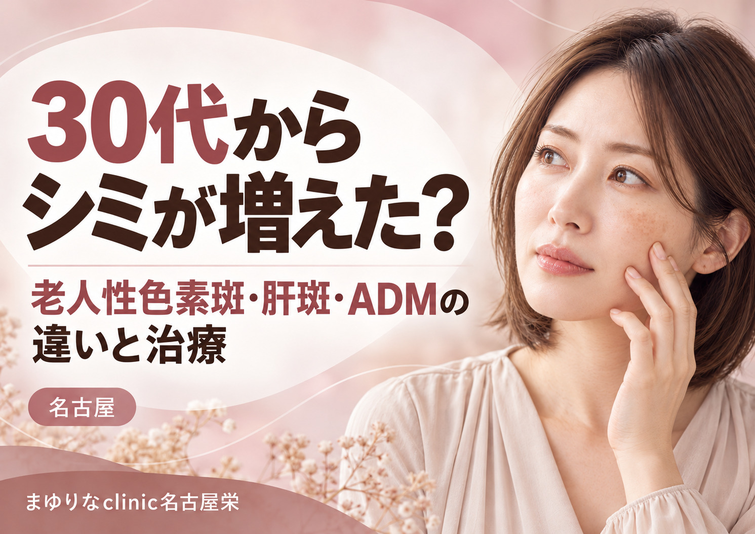 30代のシミは何が多い?ADM・老人性色素斑・肝斑・そばかす・PIHの見分け方と治療|名古屋