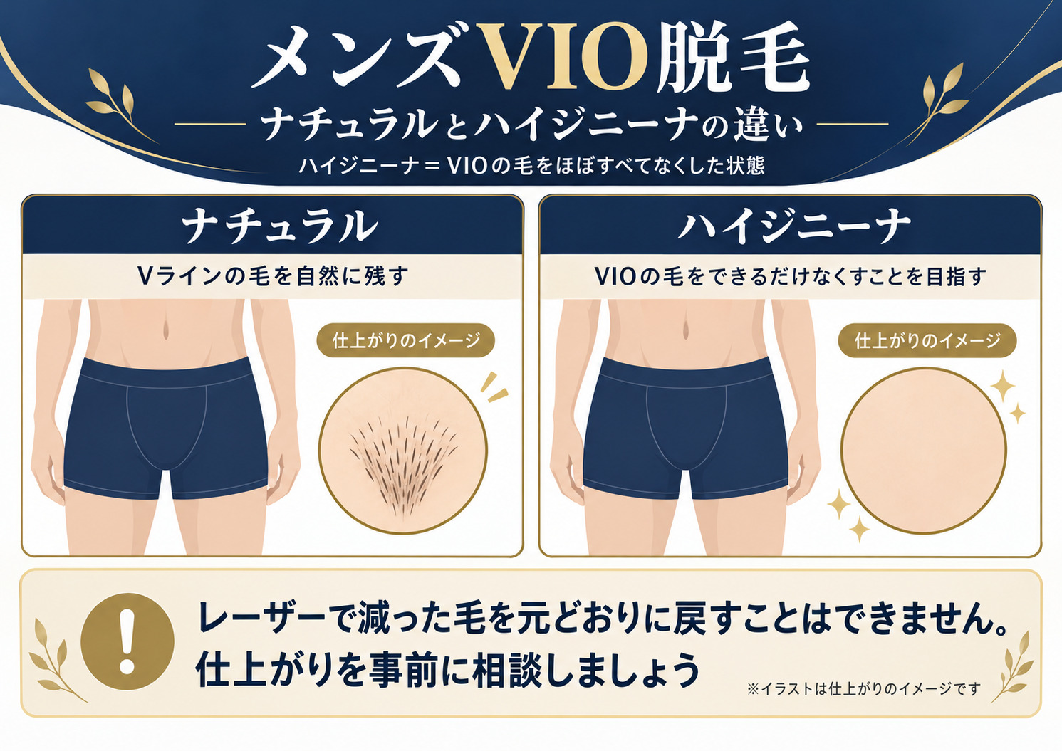 男性VIO脱毛でアンダーヘアを自然に残すナチュラルな仕上がりと、VIOの毛をほぼすべてなくすハイジニーナの違いを示した図